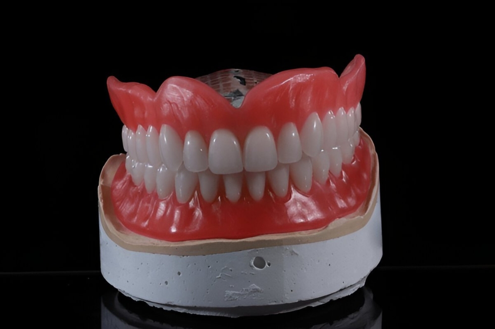 What Are the Benefits of Getting Custom Dentures from a Dentist?