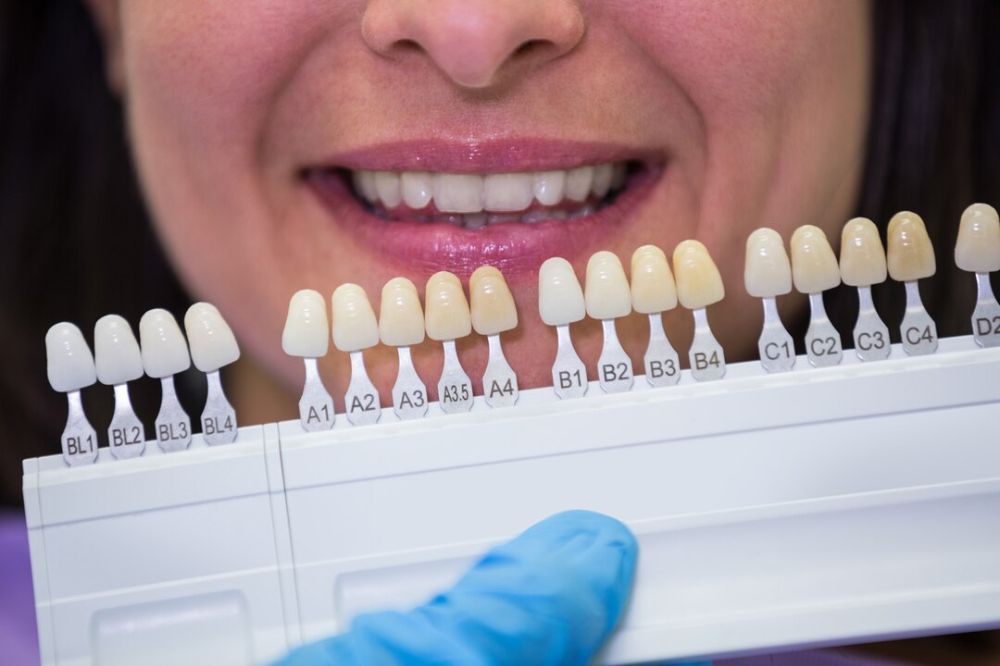What Problems Can Porcelain Veneers Fix? From Gapped Teeth to Deep Stains Explained