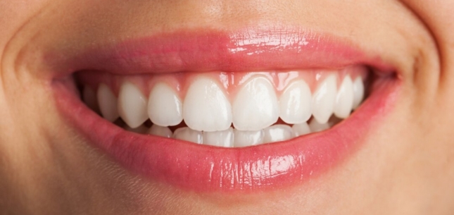 What Are the Best Teeth Whitening Options in Vancouver? From Laser to Custom Trays Explained