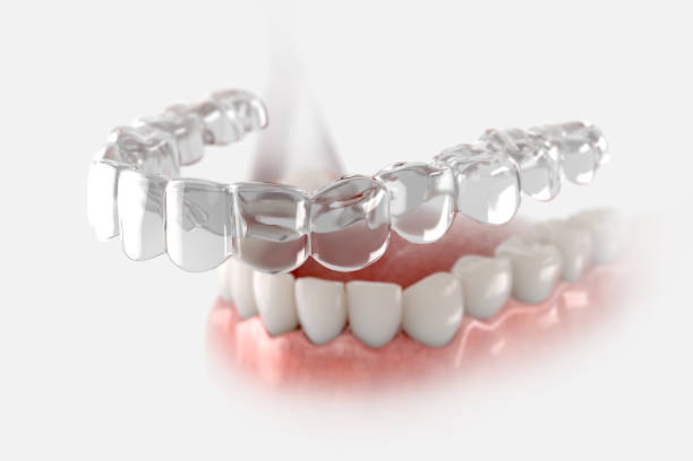 Invisalign Maintenance Guide: Daily Habits for Better Results
