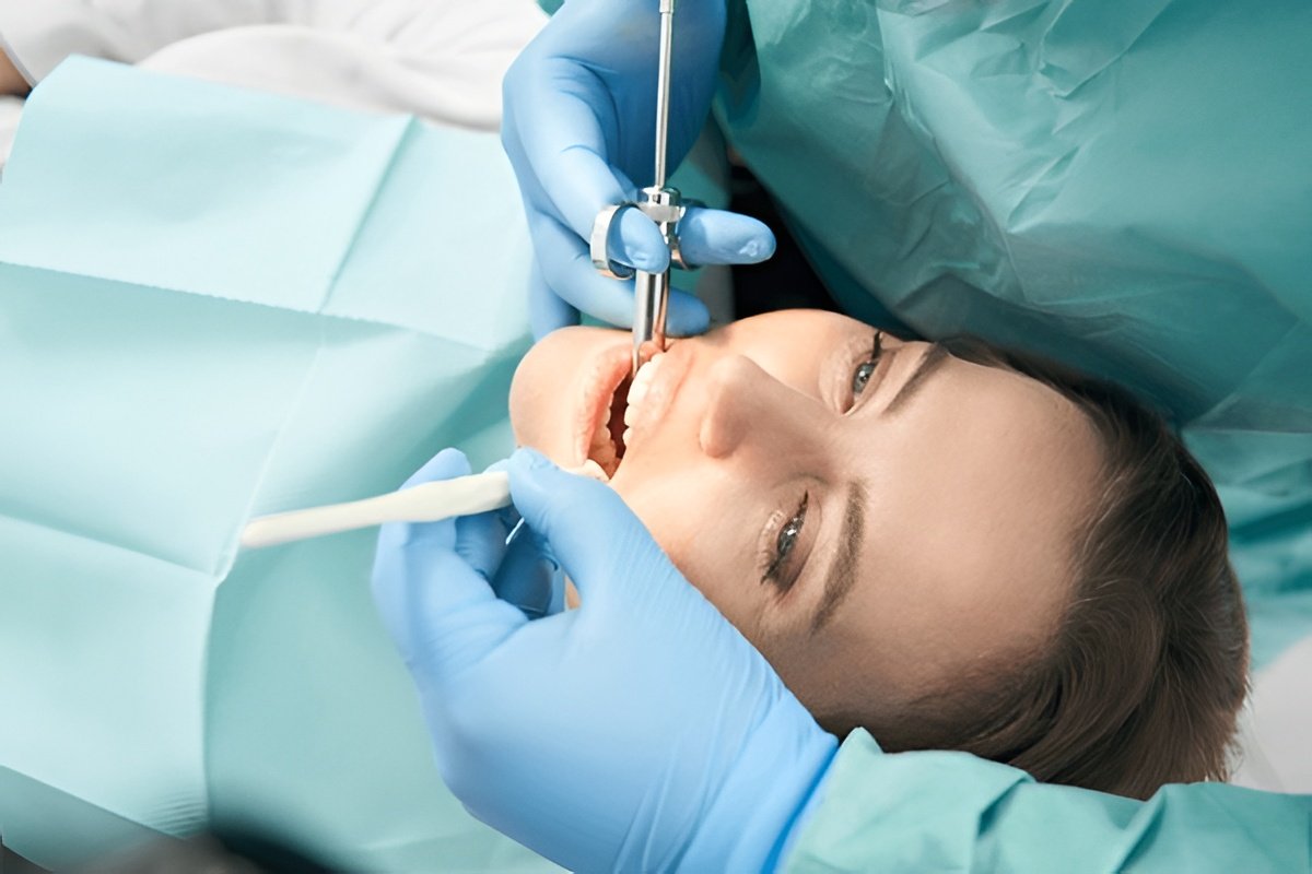 iv sedation in vancouver iv sedation in vancouver